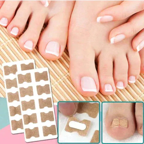 Careovate Vibrators Nail Correction Patches